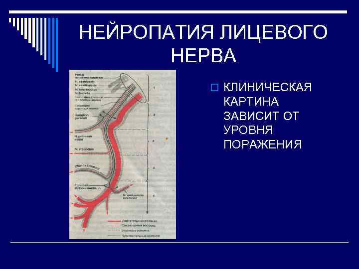 НЕЙРОПАТИЯ ЛИЦЕВОГО НЕРВА o КЛИНИЧЕСКАЯ КАРТИНА ЗАВИСИТ ОТ УРОВНЯ ПОРАЖЕНИЯ 