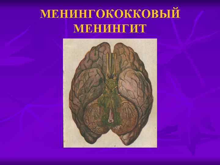 МЕНИНГОКОККОВЫЙ МЕНИНГИТ 