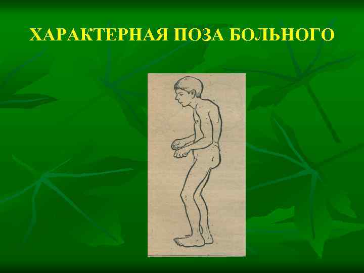 ХАРАКТЕРНАЯ ПОЗА БОЛЬНОГО 