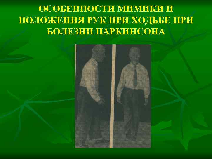 ОСОБЕННОСТИ МИМИКИ И ПОЛОЖЕНИЯ РУК ПРИ ХОДЬБЕ ПРИ БОЛЕЗНИ ПАРКИНСОНА 