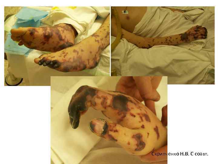 Скрипченко Н. В. С соавт. 