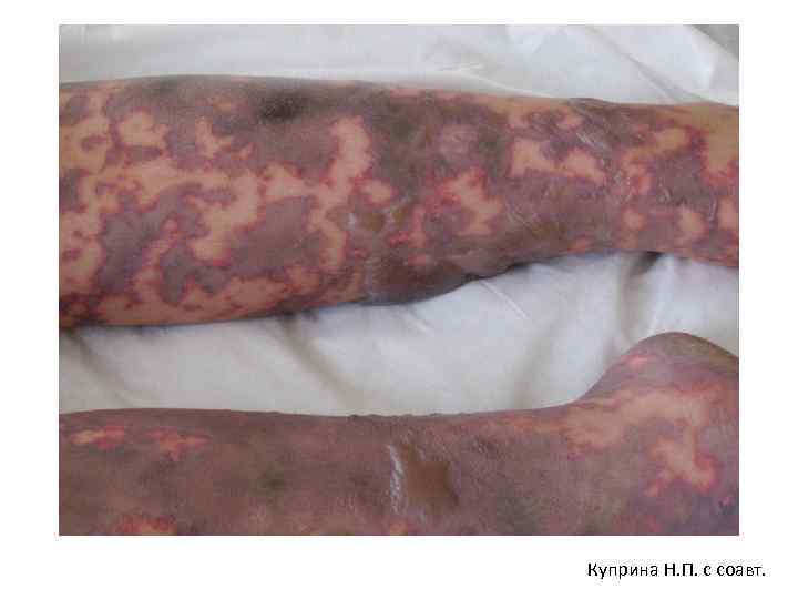 Куприна Н. П. с соавт. 