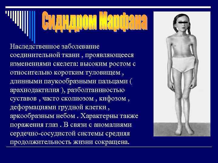 Наследственное заболевание соединительной ткани , проявляющееся изменениями скелета: высоким ростом с относительно коротким туловищем