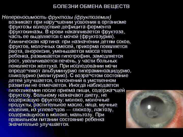 БОЛЕЗНИ ОБМЕНА ВЕЩЕСТВ Непереносимость фруктозы (фруктоземия) возникает при нару¬шении усвоения в организме фруктозы вследствие