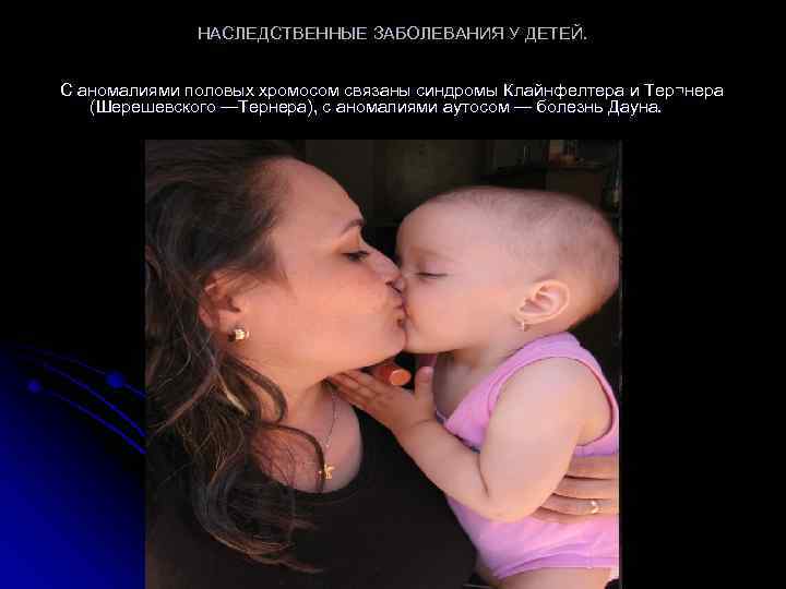 НАСЛЕДСТВЕННЫЕ ЗАБОЛЕВАНИЯ У ДЕТЕЙ. С аномалиями половых хромосом связаны синдромы Клайнфелтера и Тер¬нера (Шерешевского