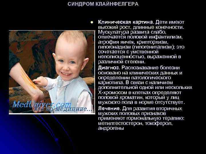 СИНДРОМ КЛАЙНФЕЛГЕРА l l l Клиническая картина. Дети имеют высокий рост, длинные конечности. Мускулатура