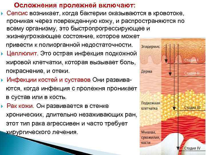 Схема иммунопатогенеза сепсиса