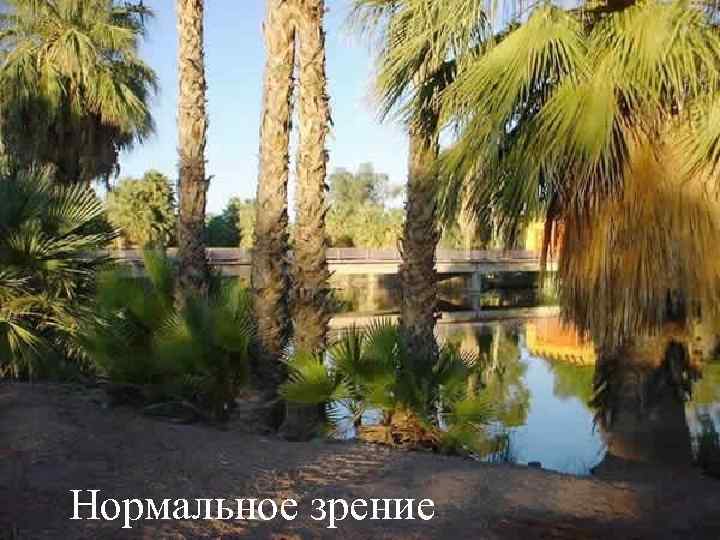 Нормальное зрение 