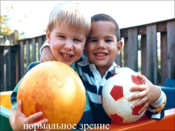 нормальное зрение 