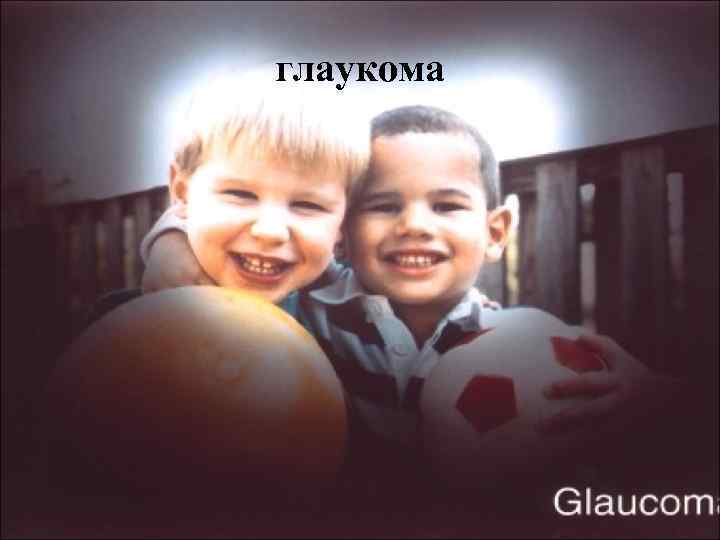 глаукома 