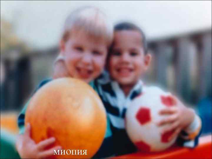 миопия 