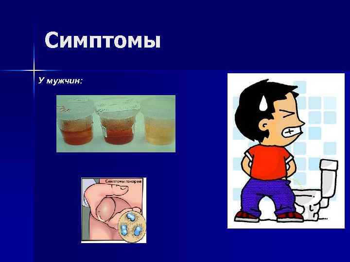 Симптомы У мужчин: 