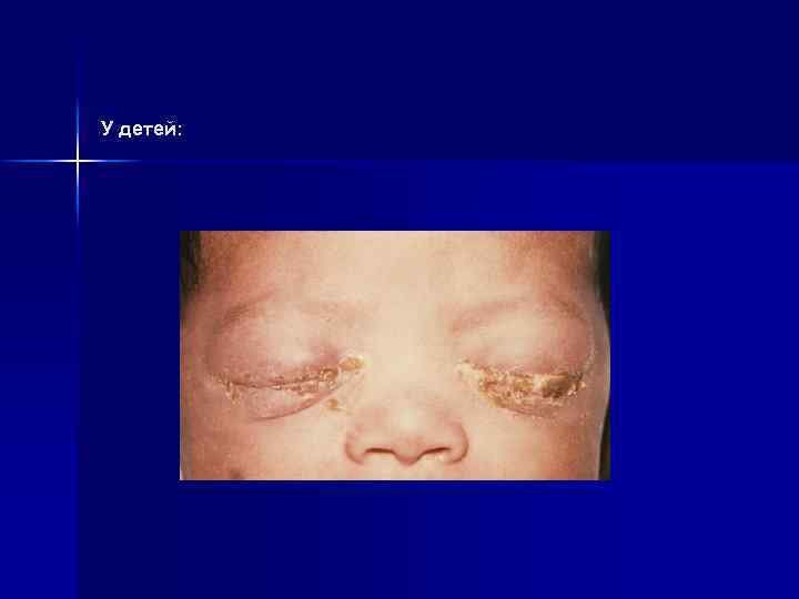 У детей: 
