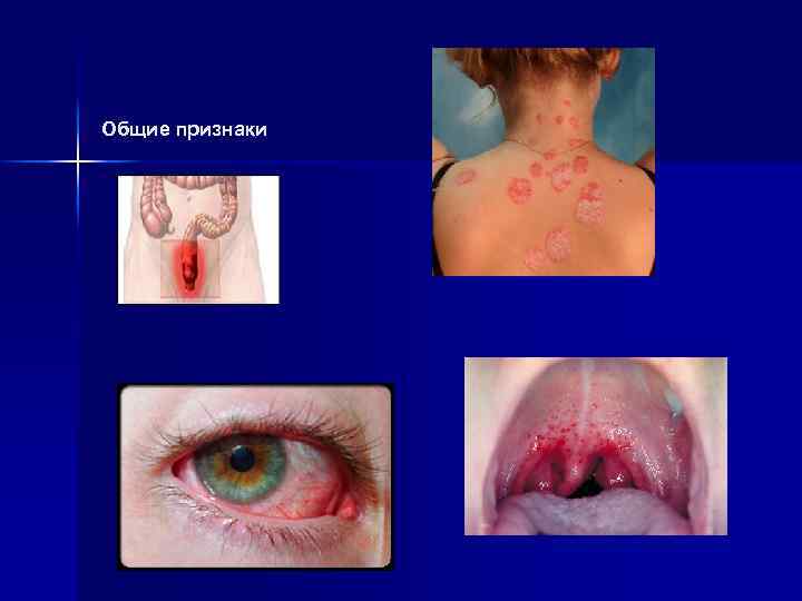 Общие признаки 