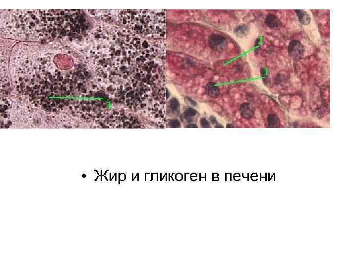  • Жир и гликоген в печени 
