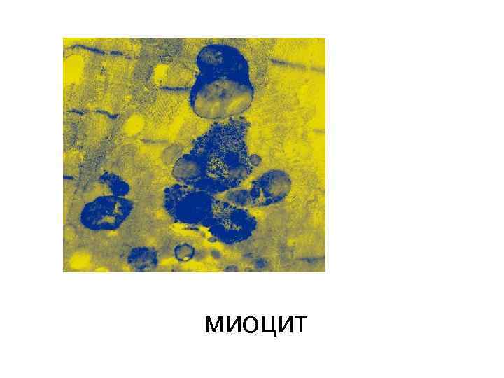 миоцит 