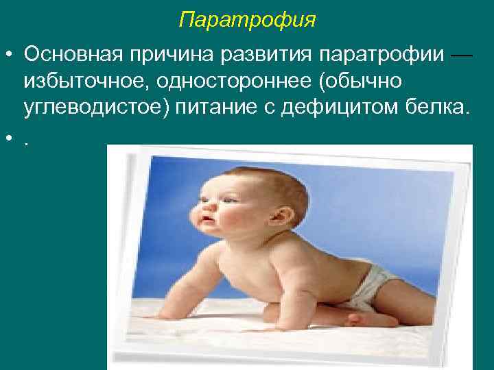 Паратрофия • Основная причина развития паратрофии — избыточное, одностороннее (обычно углеводистое) питание с дефицитом