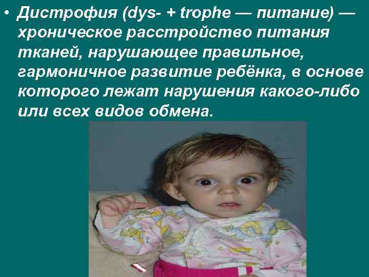  • Дистрофия (dys- + trophe — питание) — хроническое расстройство питания тканей, нарушающее