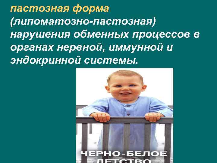 пастозная форма (липоматозно-пастозная) нарушения обменных процессов в органах нервной, иммунной и эндокринной системы. 