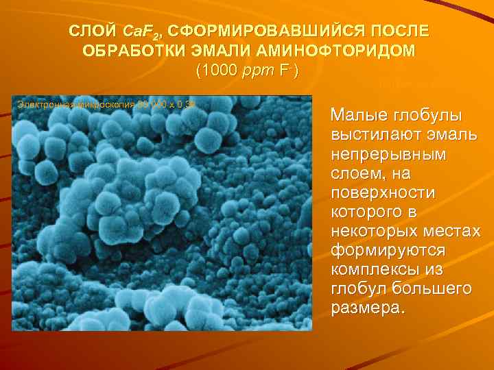 СЛОЙ Ca. F 2, СФОРМИРОВАВШИЙСЯ ПОСЛЕ ОБРАБОТКИ ЭМАЛИ АМИНОФТОРИДОМ (1000 ppm F-) Barbakow et