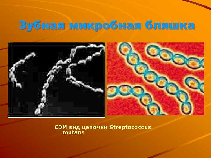 Зубная микробная бляшка СЭМ вид цепочки Streptococcus mutans 