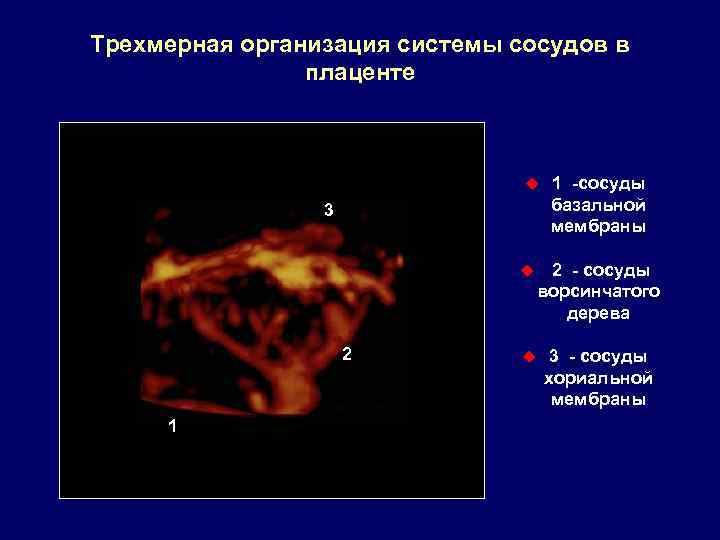 Трехмерная организация системы сосудов в плаценте u 3 u 2 1 1 -сосуды базальной