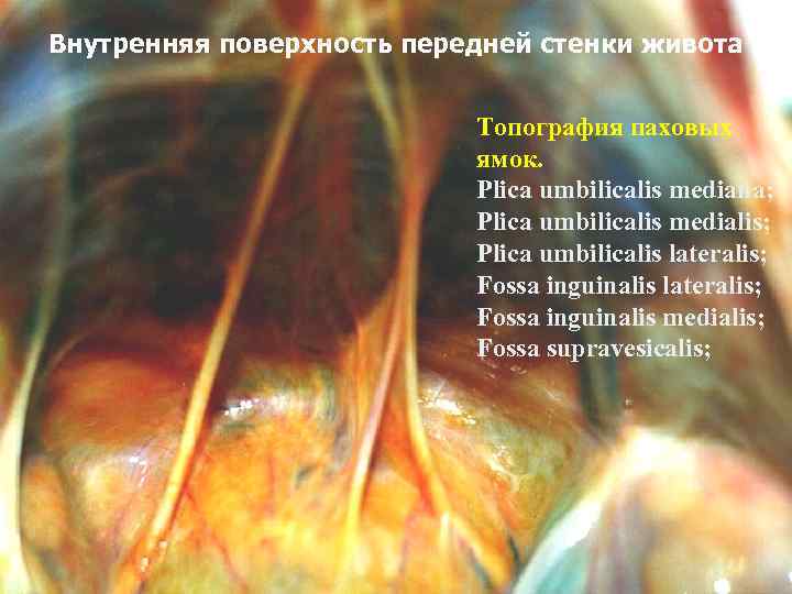 Внутренняя поверхность передней стенки живота Топография паховых ямок. Plica umbilicalis mediana; Plica umbilicalis medialis;