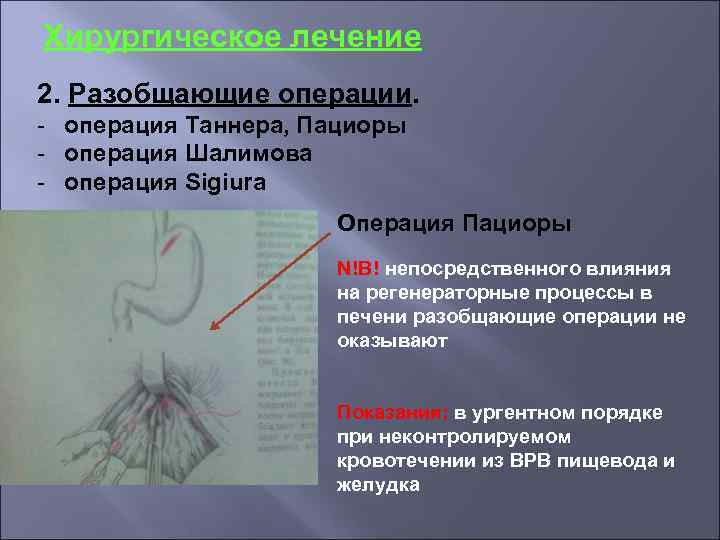 Хирургическое лечение 2. Разобщающие операции. - операция Таннера, Пациоры - операция Шалимова - операция