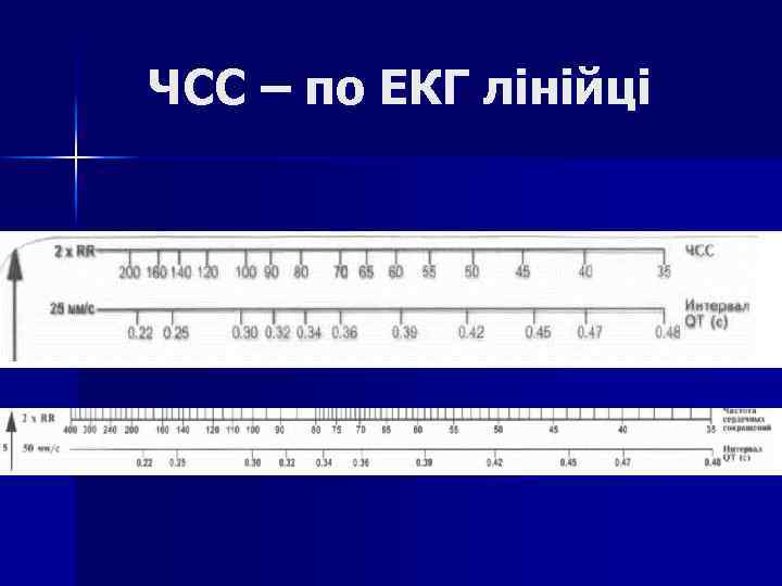 ЧСС – по ЕКГ лінійці 