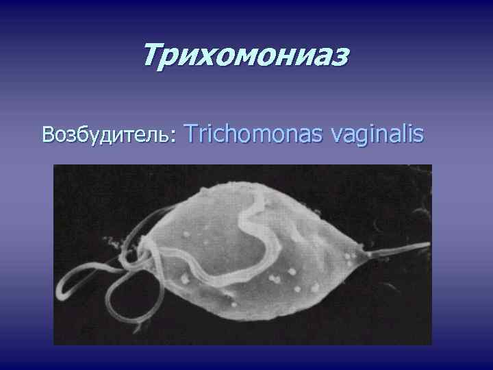 Трихомониаз Возбудитель: Trichomonas vaginalis 