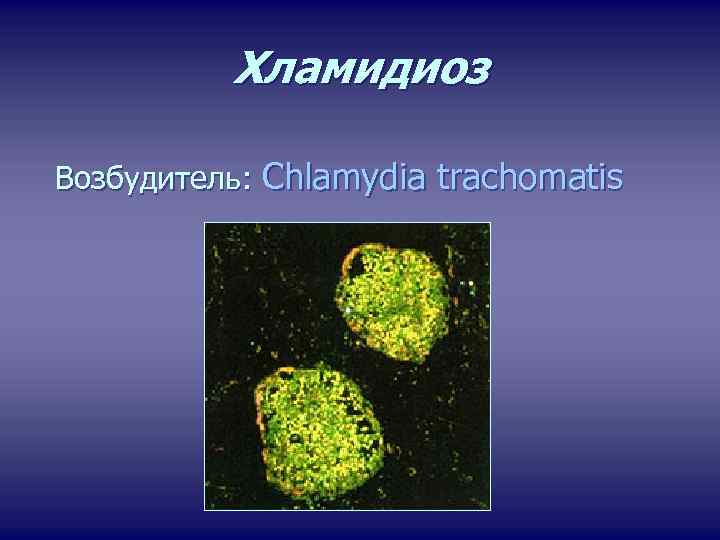 Хламидиоз Возбудитель: Chlamydia trachomatis 