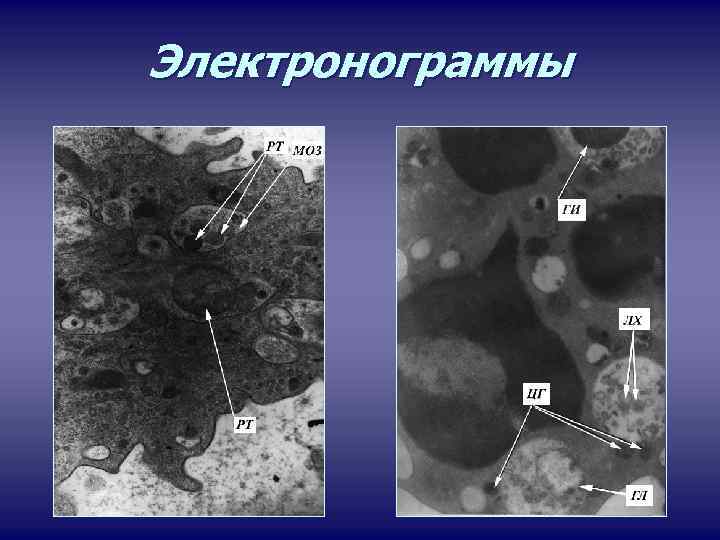 Электронограммы 