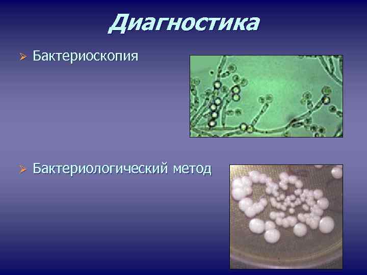 Диагностика Ø Бактериоскопия Ø Бактериологический метод 