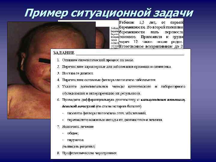 Пример ситуационной задачи 