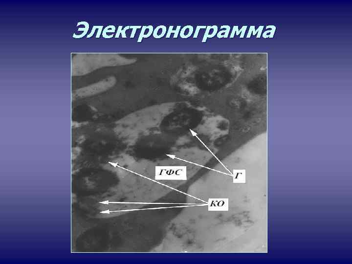 Электронограмма 