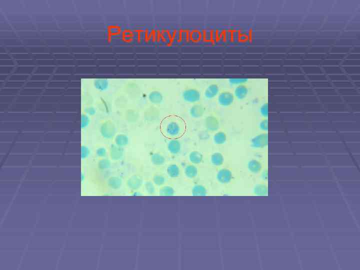 Ретикулоциты 
