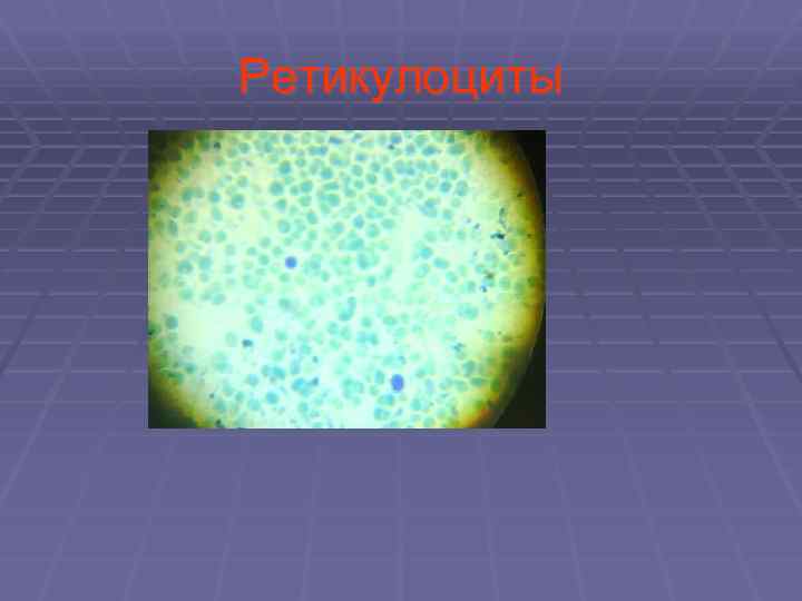 Ретикулоциты 