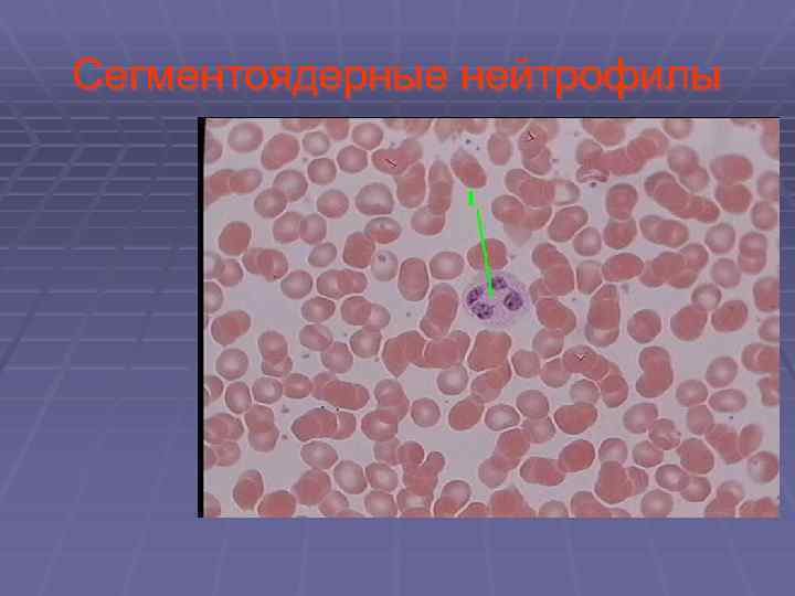 Сегментоядерные нейтрофилы 