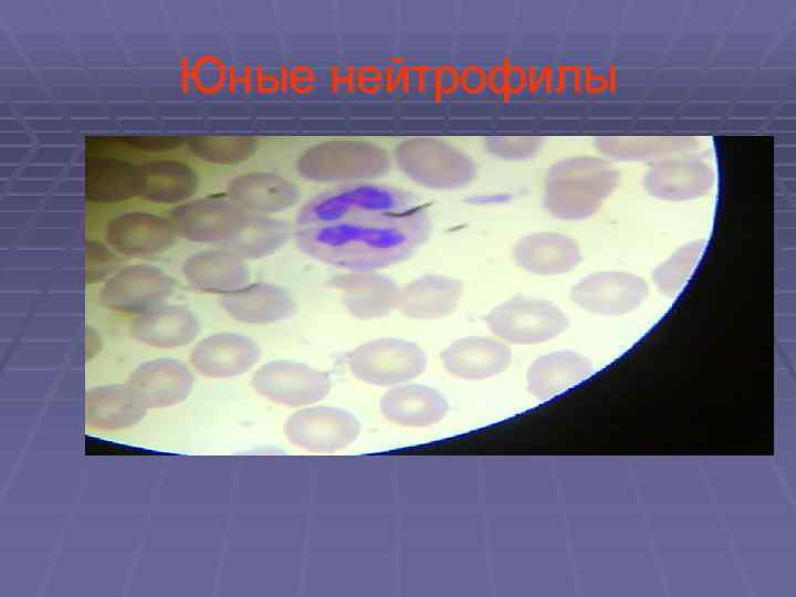 Юные нейтрофилы 