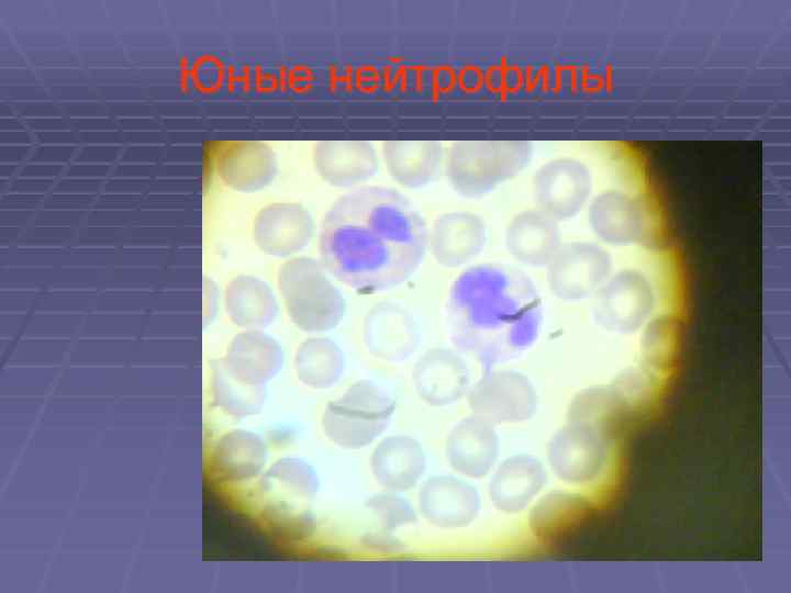 Юные нейтрофилы 