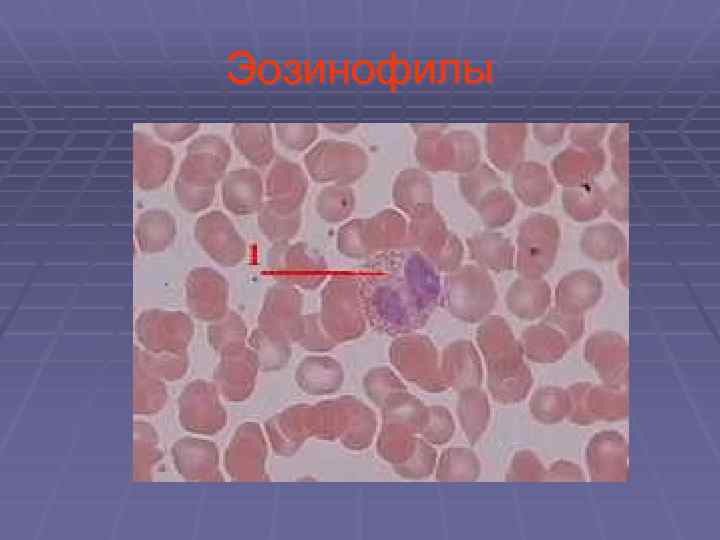 Эозинофилы 