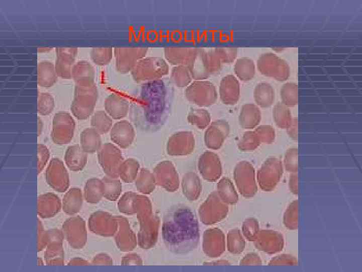 Моноциты 