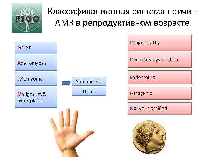 Классификационная система причин АМК в репродуктивном возрасте Coagulopathy POLYP Ovulatory dysfunction Adenomyosis Leiomyoma Malignancy&