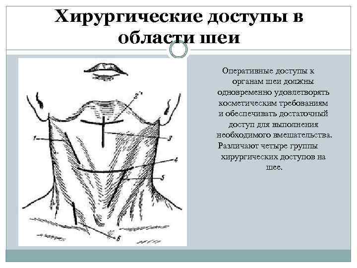 Хирургические доступы в области шеи Оперативные доступы к органам шеи должны одновременно удовлетворять косметическим