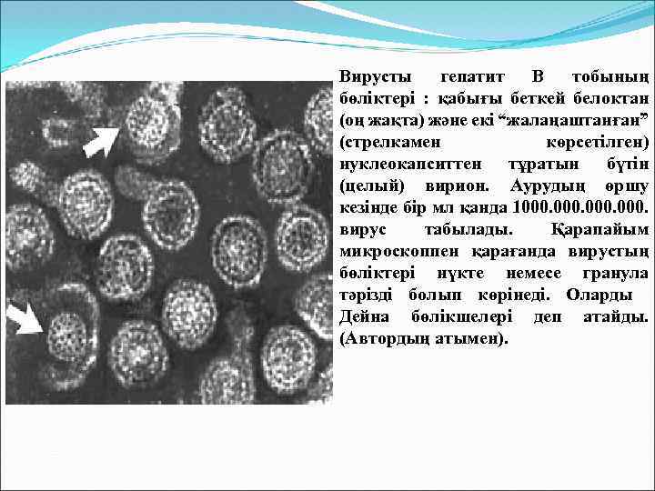 Вирусты гепатит В тобының бөліктері : қабығы беткей белоктан (оң жақта) және екі “жалаңаштанған”