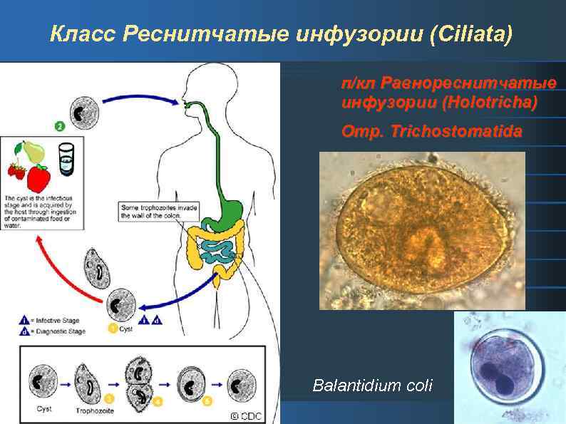 Жизненный цикл балантидий схема