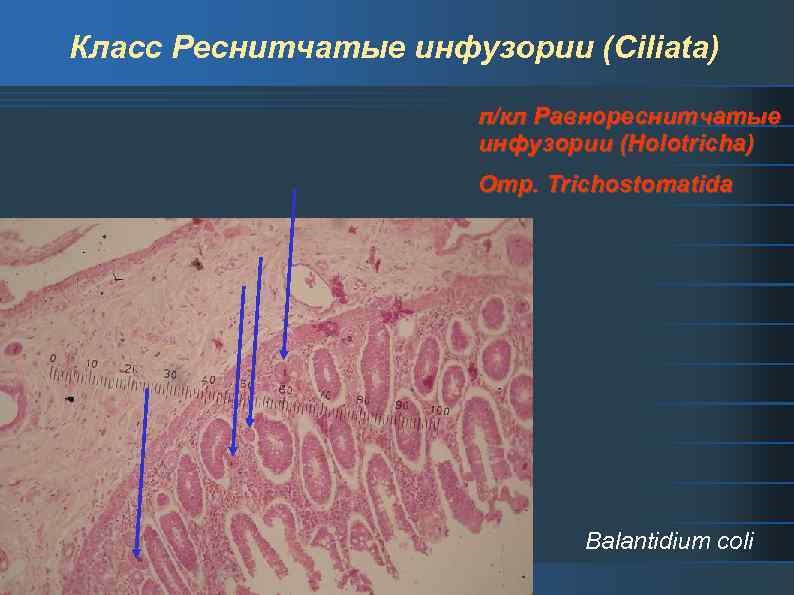 Класс Реснитчатые инфузории (Ciliata) п/кл Равнореснитчатые инфузории (Holotricha) Отр. Trichostomatida Balantidium coli 
