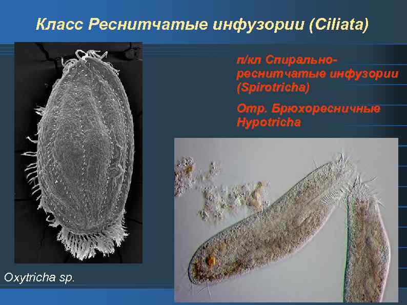 Класс Реснитчатые инфузории (Ciliata) п/кл Спиральнореснитчатые инфузории (Spirotricha) Отр. Брюхоресничные Hypotricha Oxytricha sp. 