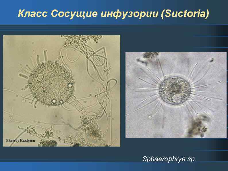 Класс Сосущие инфузории (Suctoria) Sphaerophrya sp. 