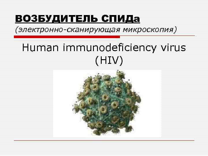 Спид возбудитель. ВИЧ СПИД возбудитель. СПИД характеристика возбудителя.